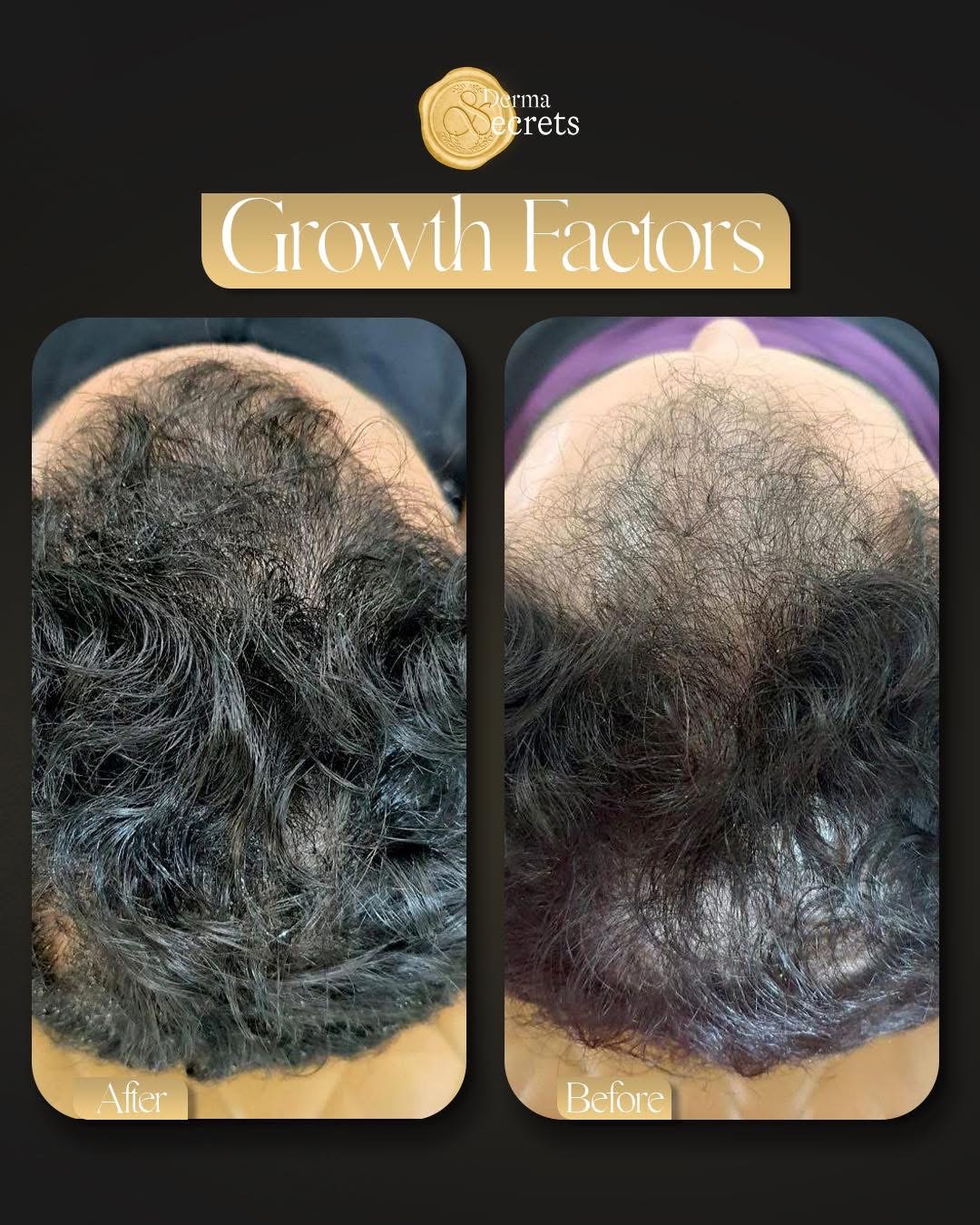 Hair exosomes and growth factors