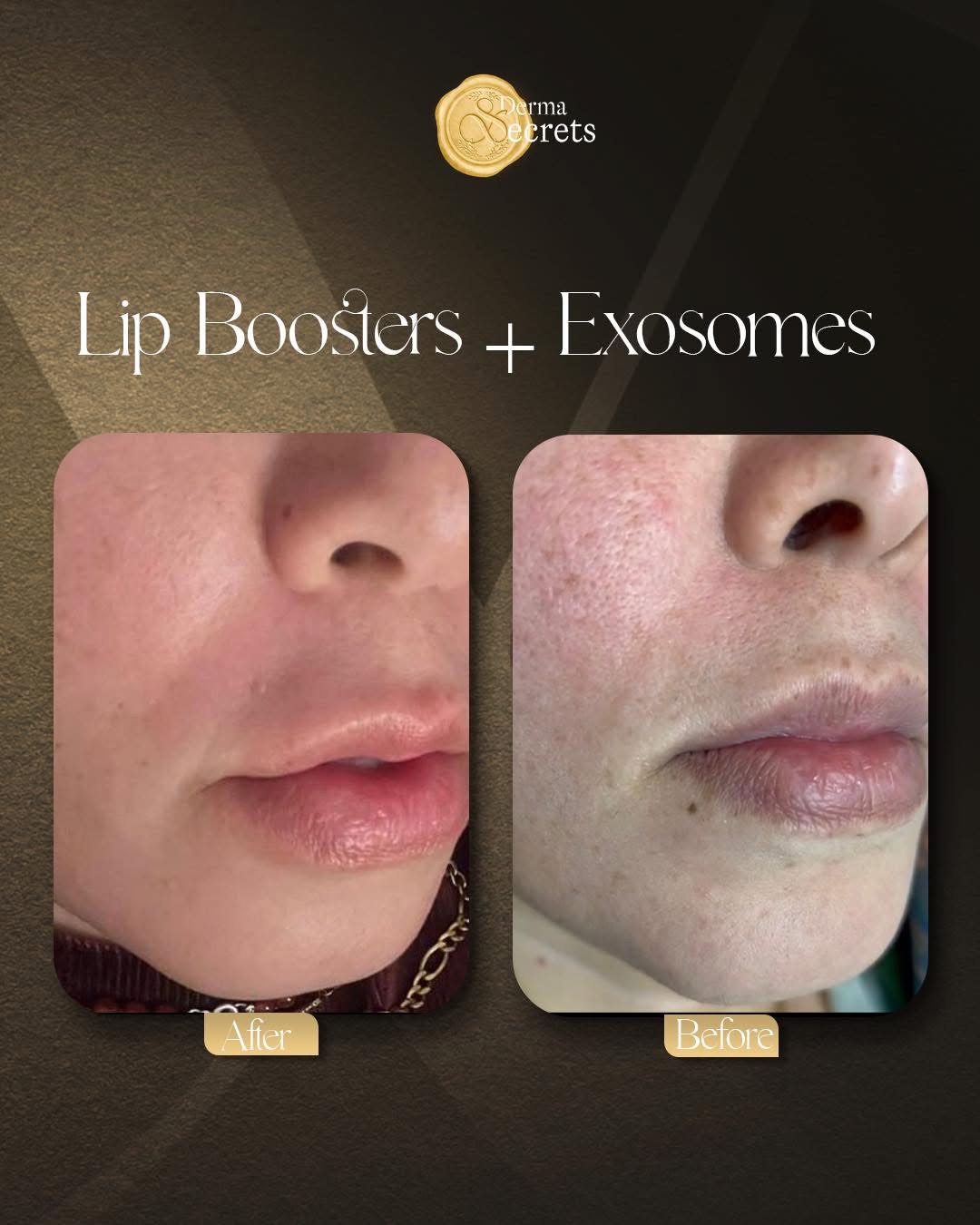 Intimate Wellness program